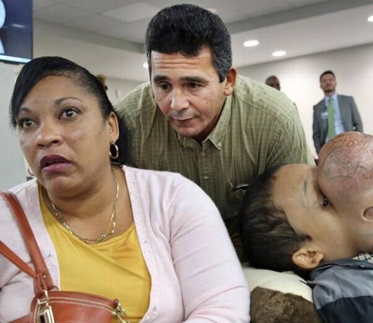 Emanuel Zayas Dies After Surgery to Remove 10-Pound Tumor From Face Emanuel Zayas Dies After Surgery to Remove 10-Pound Tumor From Face