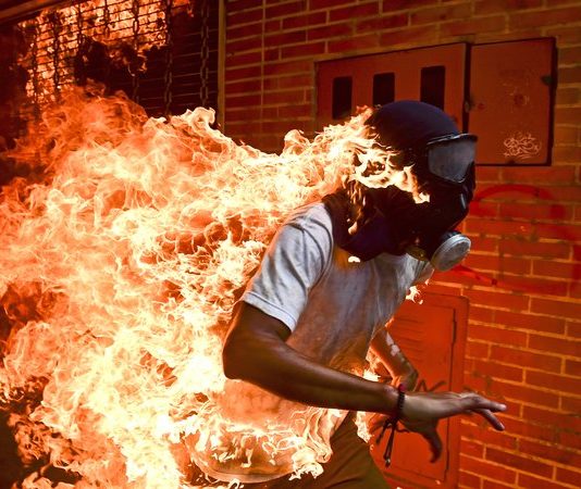‘Burning man’ photo wins top image prize ‘Burning man’ photo wins top image prize