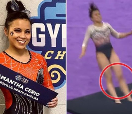 Gymnast breaks both legs during floor routine, Report Gymnast breaks both legs during floor routine, Report