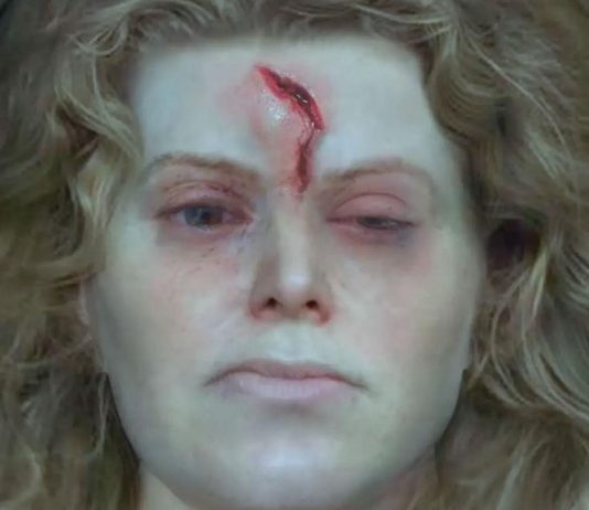 Study: Battle-Scarred Viking Shield-Maiden Gets Facial Reconstruction Study: Battle-Scarred Viking Shield-Maiden Gets Facial Reconstruction
