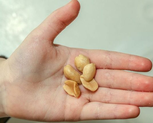 First peanut allergy treatment approved by FD First peanut allergy treatment approved by FD