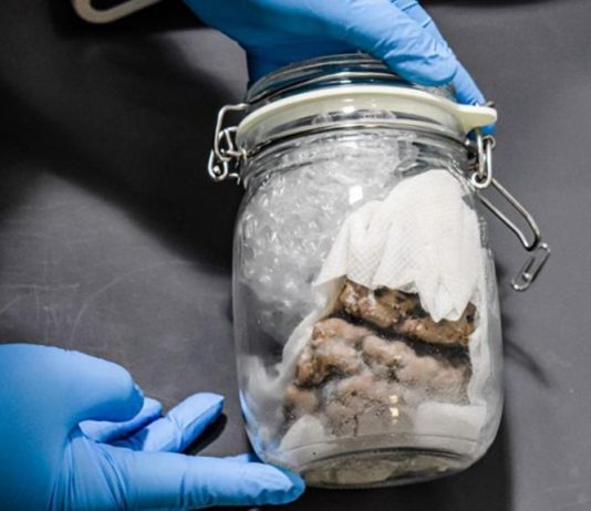 Human brain seized from Canadian mail by US customs, Report Human brain seized from Canadian mail by US customs, Report