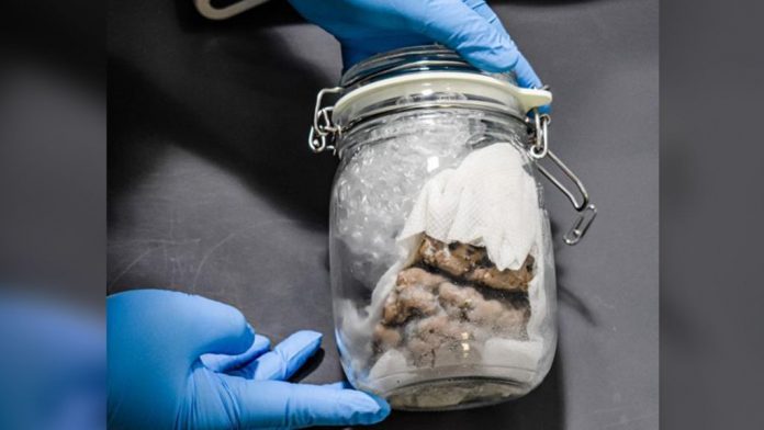 Human brain seized from Canadian mail by US customs, Report