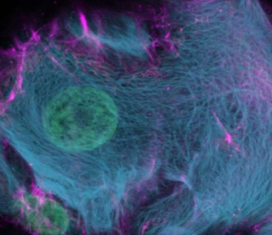 CRISPR-HOT: A new tool to ‘color’ specific genes and cells (Study) CRISPR-HOT: A new tool to 'color' specific genes and cells (Study)