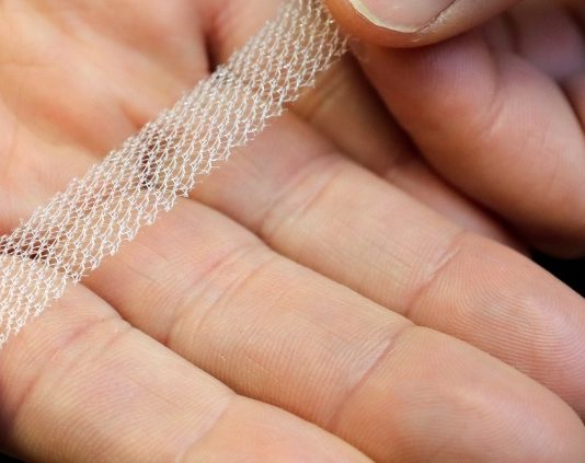 Canadian Women with transvaginal mesh implants, Report Canadian Women with transvaginal mesh implants, Report