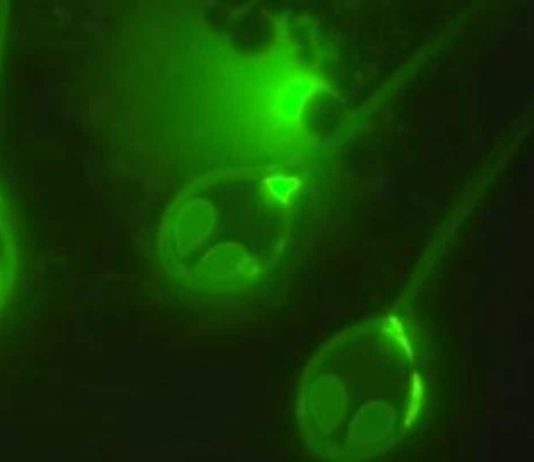 Researchers discover first animal that can survive without oxygen Researchers discover first animal that can survive without oxygen