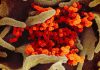 Coronavirus Canada update: Alberta reaches 50 deaths related to COVID-19