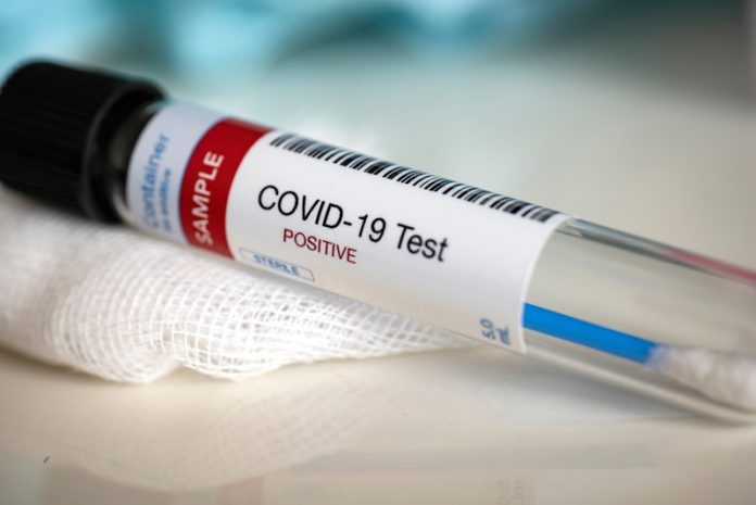 Coronavirus Canada Updates: 4 Deaths, 64 New Cases Of COVID-19 In Windsor Essex As Of Saturday