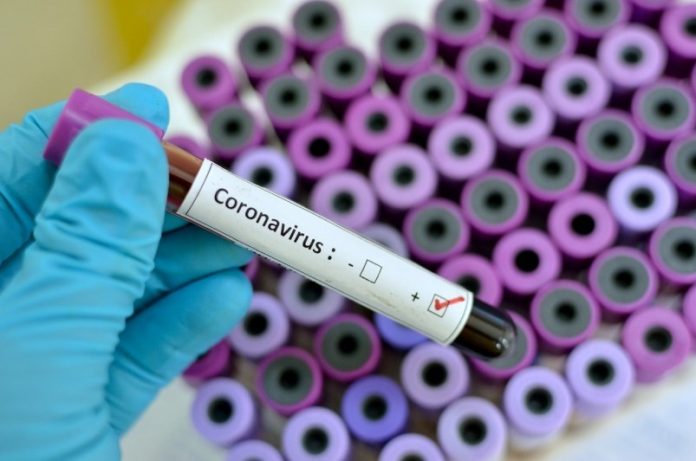 Coronavirus Canada updates: Ontario reports 634 new COVID-19 cases, 54 more deaths