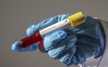 Coronavirus Canada Updates: Saskatchewan has 328 new COVID cases, 300 new recoveries