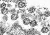 Coronavirus Canada Updates: COVID-19 cases confirmed at 5 Saskatoon schools