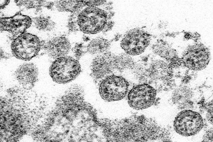 Coronavirus Canada Updates: COVID-19 cases confirmed at 5 Saskatoon schools