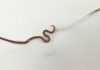 Doctors pull 1.5-inch worm from woman's tonsils (Photo)