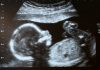 Report: Mother transmitted COVID-19 to baby during pregnancy
