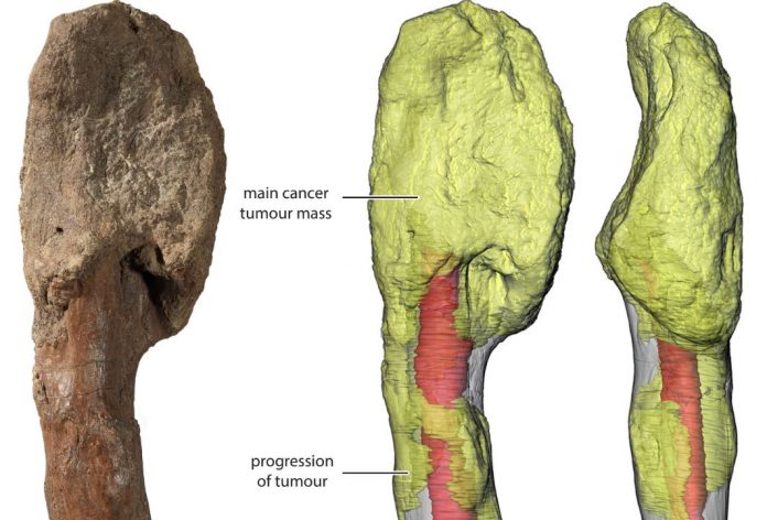Researchers Identify Cancer in a Dinosaur Fossil for the First Time
