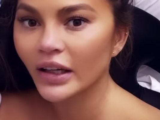 Chrissy Teigen hospitalized for Excessive Bleeding, Report Chrissy Teigen hospitalized for Excessive Bleeding, Report