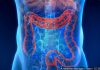 Colon Cancer Screening Should Start Earlier, at Age 45, panel recommends