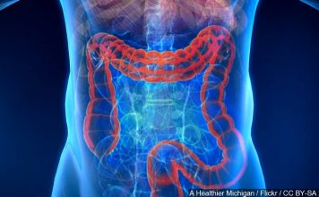 Colon Cancer Screening Should Start Earlier, at Age 45, panel recommends Colon Cancer Screening Should Start Earlier, at Age 45, panel recommends