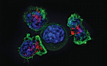 New immunotherapy shows promise against rare childhood cancer (Study) New immunotherapy shows promise against rare childhood cancer (Study)