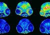 Alzheimer's disease: regulating copper in the brain stops memory loss among mice (Study)