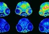 Alzheimer’s disease: regulating copper in the brain stops memory loss among mice (Study) Alzheimer's disease: regulating copper in the brain stops memory loss among mice (Study)