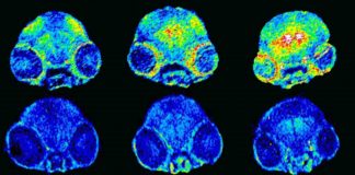 Alzheimer’s disease: regulating copper in the brain stops memory loss among mice (Study) Alzheimer's disease: regulating copper in the brain stops memory loss among mice (Study)