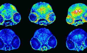 Alzheimer’s disease: regulating copper in the brain stops memory loss among mice (Study) Alzheimer's disease: regulating copper in the brain stops memory loss among mice (Study)