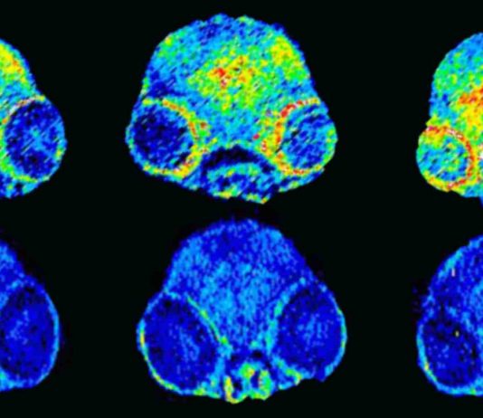 Alzheimer’s disease: regulating copper in the brain stops memory loss among mice (Study) Alzheimer's disease: regulating copper in the brain stops memory loss among mice (Study)