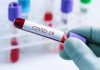 Coronavirus: Saskatchewan Records 111 New Cases Of COVID-19 today