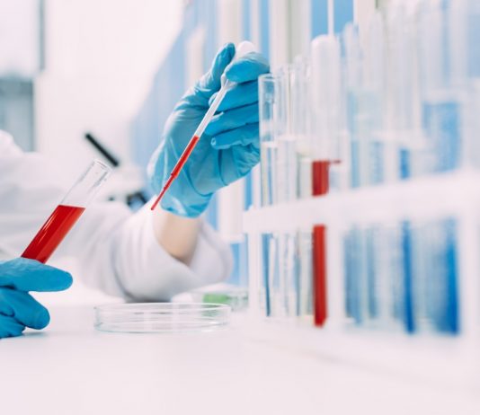 First blood test to help diagnose Alzheimer’s goes public, Report First blood test to help diagnose Alzheimer's goes public, Report