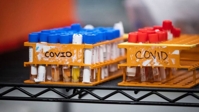 Coronavirus: Nova Scotia reports 426 new cases of COVID-19, another record