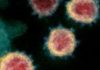 Coronavirus: 36 new COVID-19 cases, 114 recoveries reported in Saskatchewan