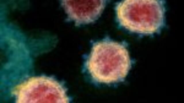 Coronavirus: 36 new COVID-19 cases, 114 recoveries reported in Saskatchewan